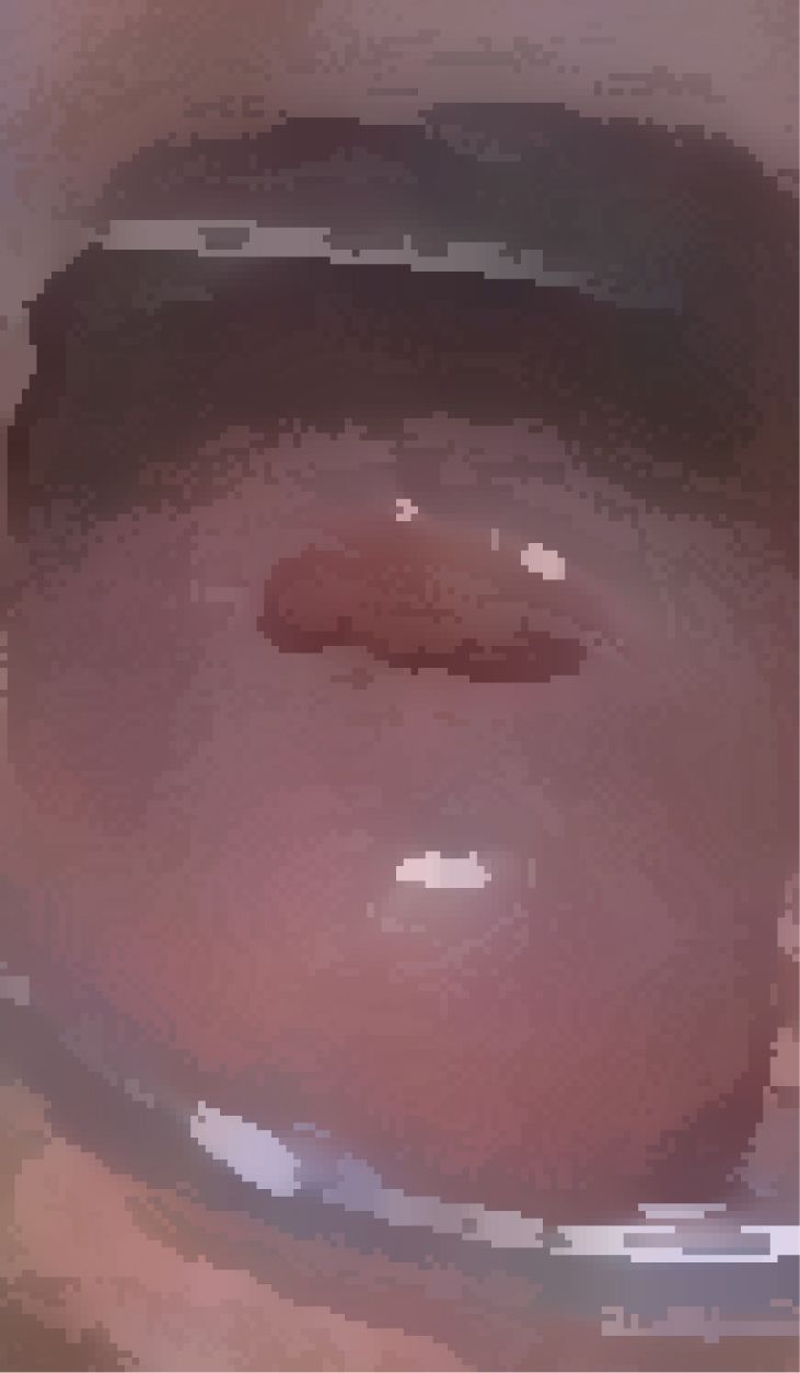 私の蟲姦遊び 第15話 妊娠中にムカデとムカデの卵編