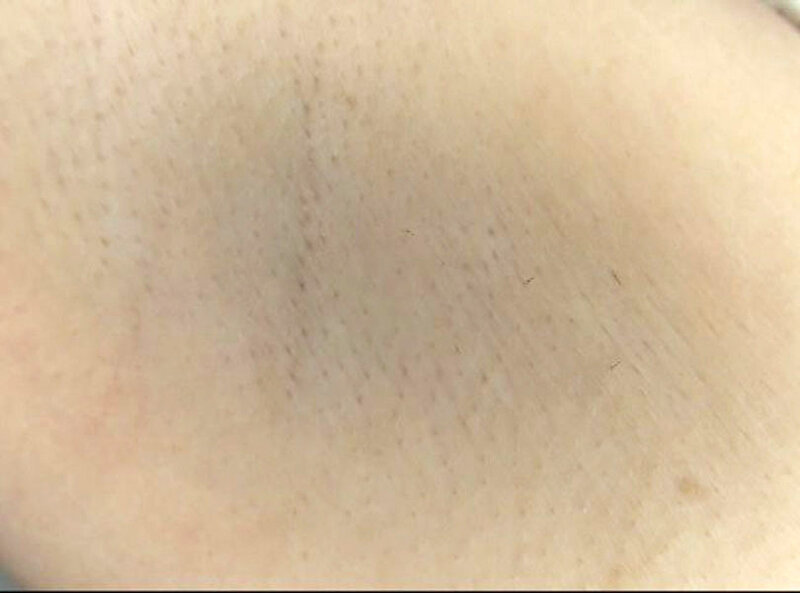 300人の腋 2