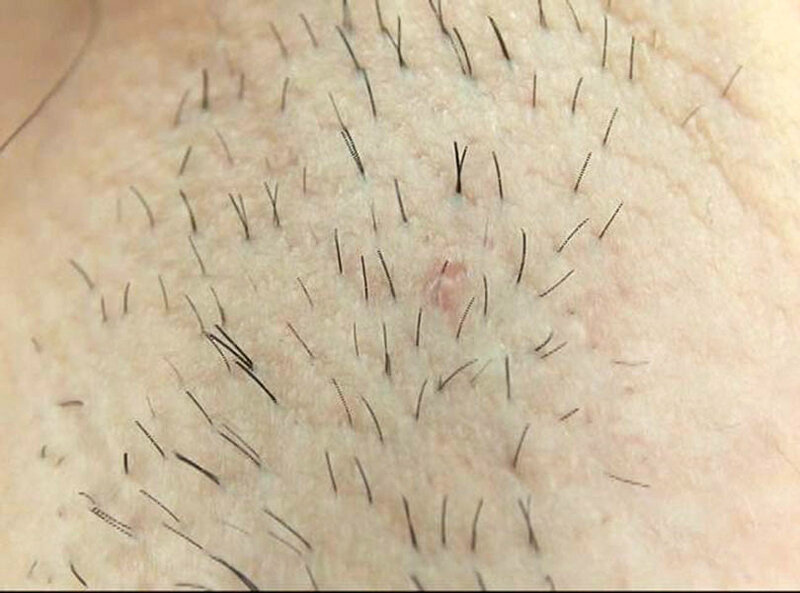 300人の腋 2