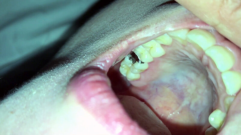 女体観察Vol2口腔観察編