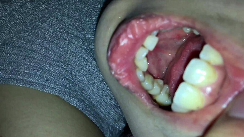 女体観察Vol2口腔観察編