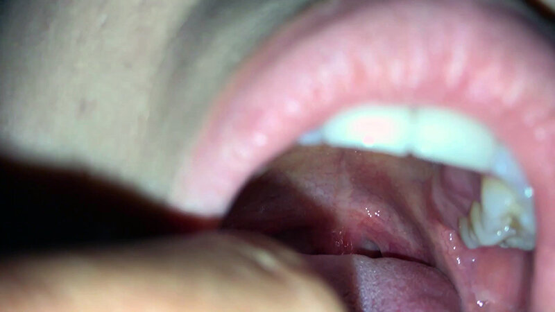 女体観察Vol2口腔観察編