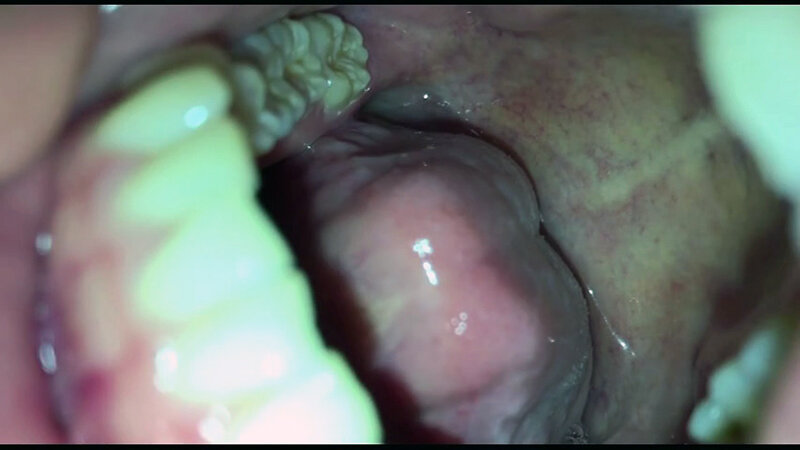 女体観察Vol5口腔観察編