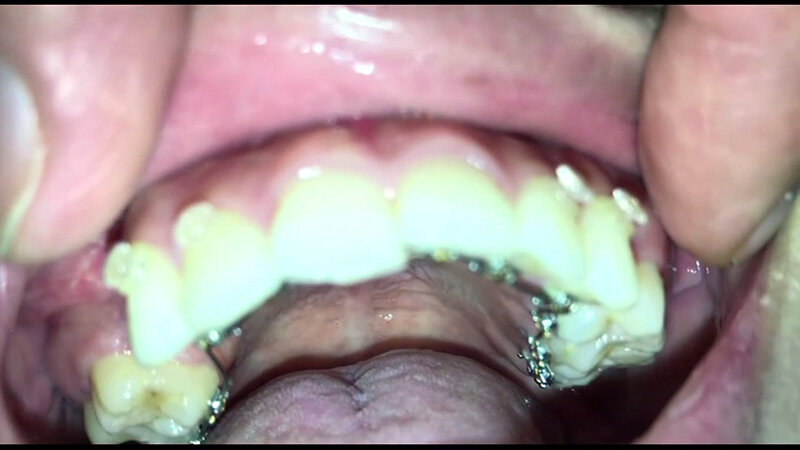 女体観察Vol5口腔観察編