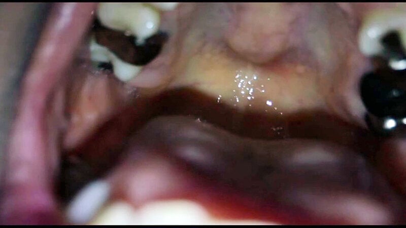 女体観察Vol5口腔観察編