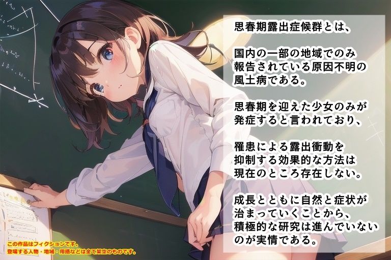 思春期☆露出症候群