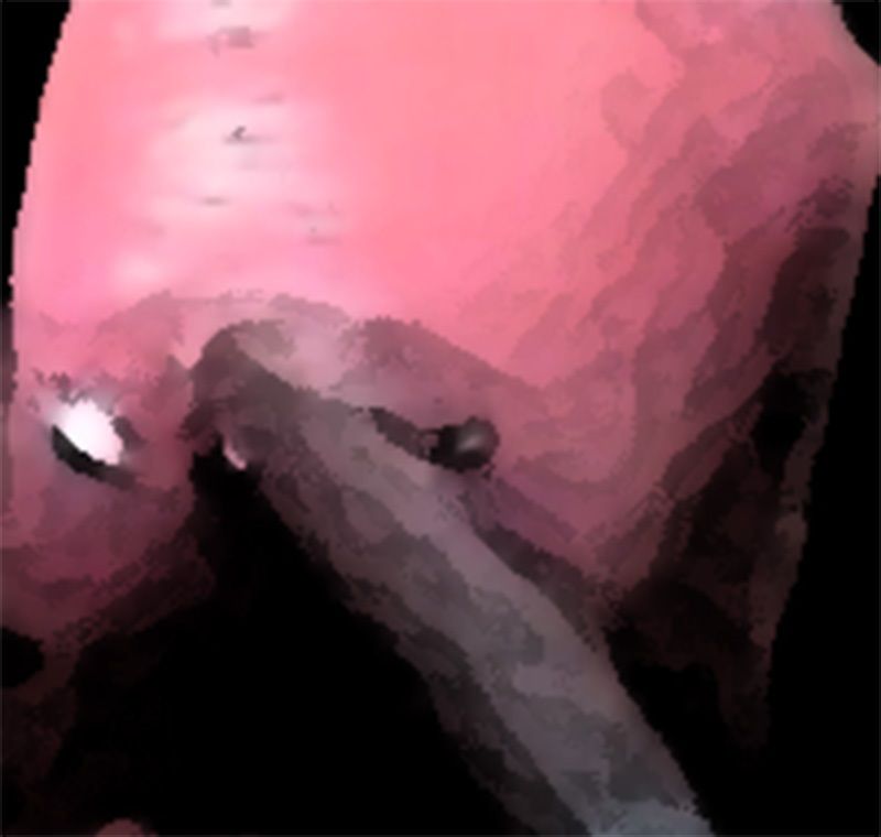 私の蟲姦遊び 18話 妊娠中に5 匹のミズアブの幼虫編