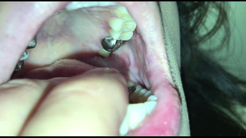 女体観察Vol6口腔観察編