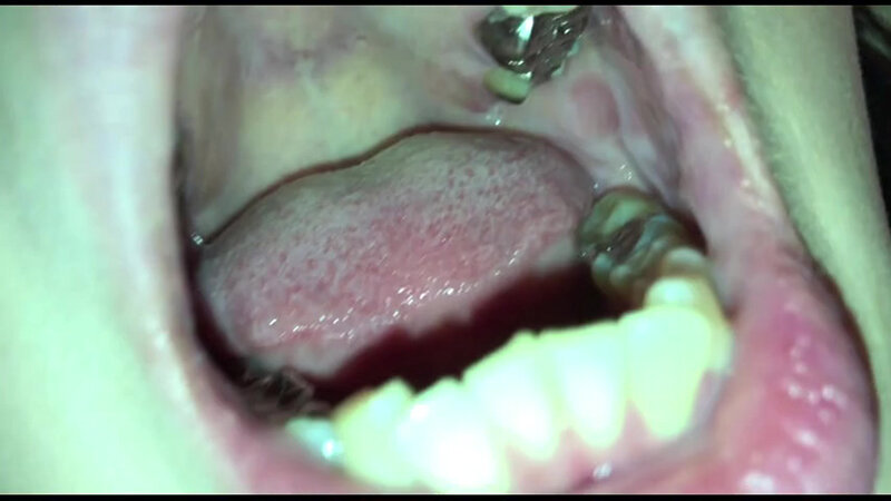 女体観察Vol6口腔観察編