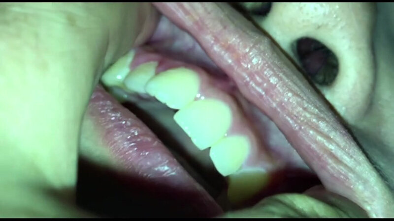 女体観察Vol6口腔観察編