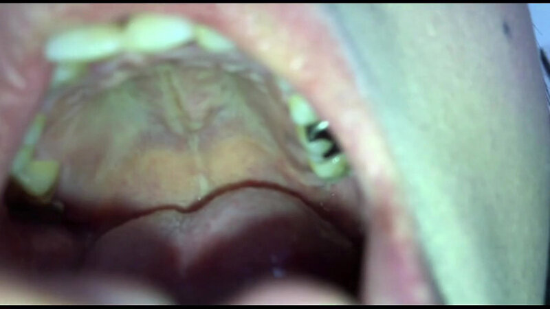 女体観察Vol6口腔観察編