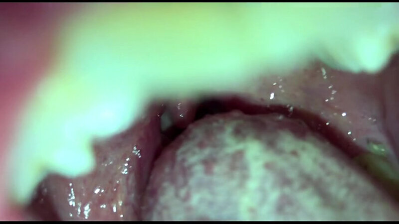 女体観察Vol6口腔観察編