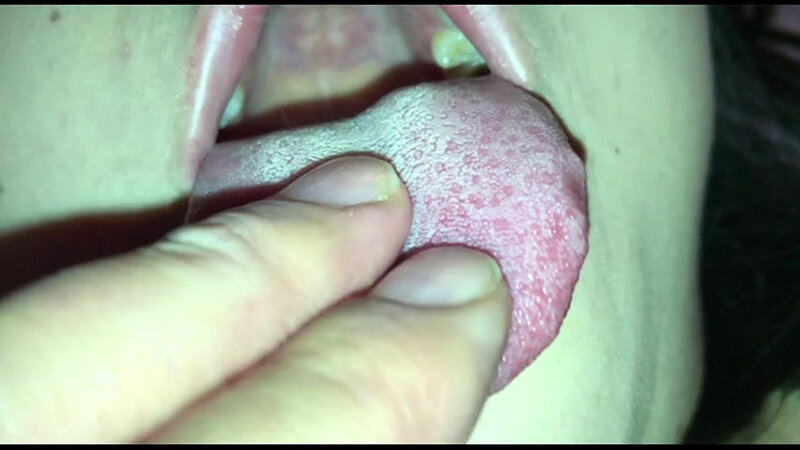 女体観察Vol6口腔観察編