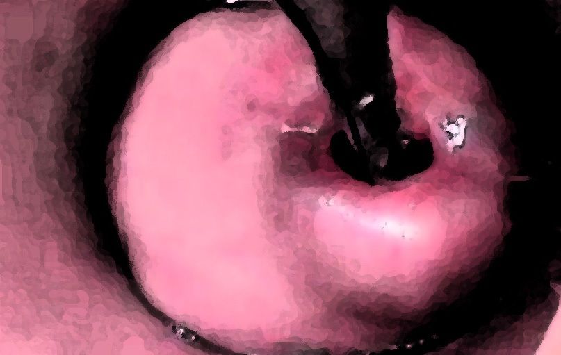 私の蟲姦遊び 19話 妊娠中に2匹のゴキブリの幼虫編