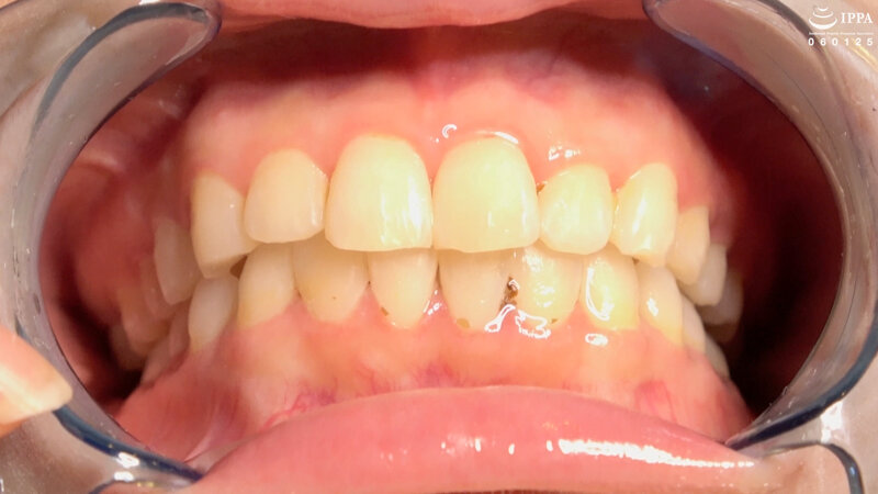 エッチなお姉さんの舌ベロ歯のどちんこをしっかり観察してみた 香椎佳穂