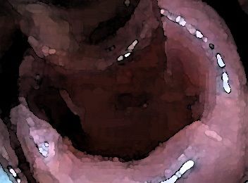 私の蟲姦遊び 22話 妊娠中にハサミムシ編 全編