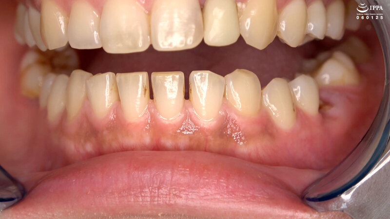 「超オススメ!人気女優 乃木ちはるチャンの舌ベロ・口内・歯・のどちんこ観察!」