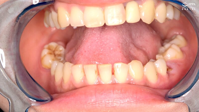 「超オススメ!人気女優 乃木ちはるチャンの舌ベロ・口内・歯・のどちんこ観察!」