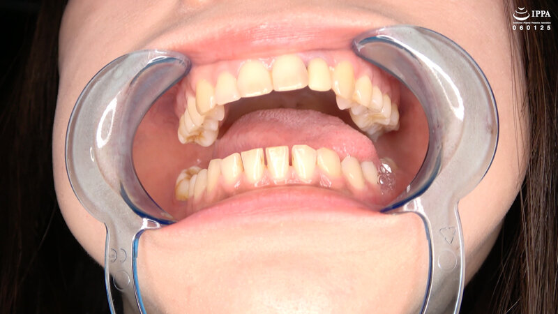 「超オススメ!人気女優 乃木ちはるチャンの舌ベロ・口内・歯・のどちんこ観察!」