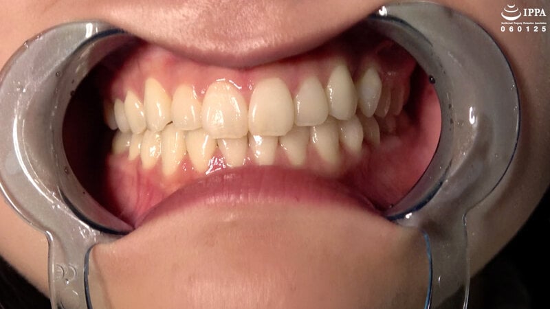 人気女優 有加里ののかチャンの歯・口内・のどちんこ観察＆顔舐め鼻フェラプレイ！！！