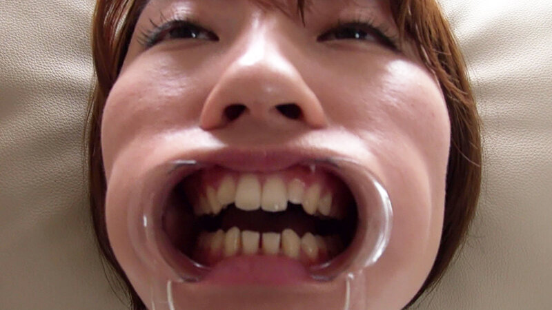 はじめての口枷