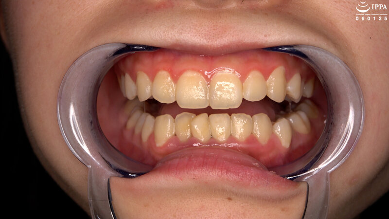 【歯・口腔】ドM女子の激レアな口内・歯・のどちんこ観察★ 伊織ひなの