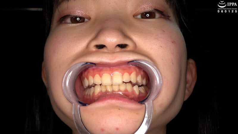 【歯・口腔】ドM女子の激レアな口内・歯・のどちんこ観察★ 伊織ひなの