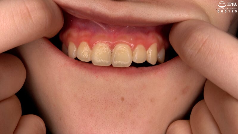 【歯・口腔】ドM女子の激レアな口内・歯・のどちんこ観察★ 伊織ひなの