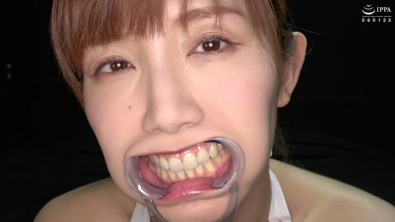 【歯・口内フェチ】綺麗なお姉さんの激レアな治療跡がある歯・口内・のどちんこ観察! 美泉咲