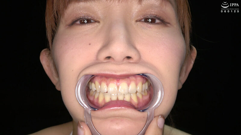 【歯・口内フェチ】綺麗なお姉さんの激レアな治療跡がある歯・口内・のどちんこ観察! 美泉咲