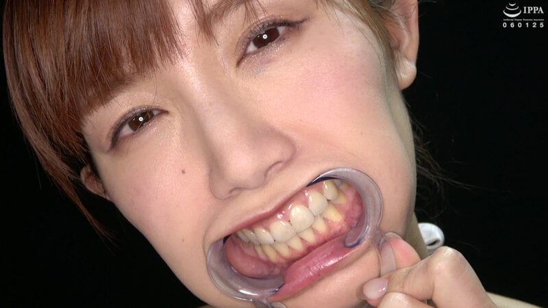 【歯・口内フェチ】綺麗なお姉さんの激レアな治療跡がある歯・口内・のどちんこ観察! 美泉咲