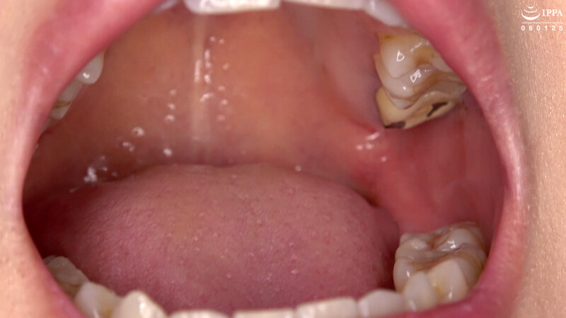 【歯・口内フェチ】綺麗なお姉さんの激レアな治療跡がある歯・口内・のどちんこ観察! 美泉咲