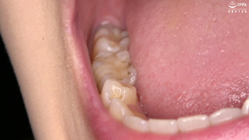 【歯・口内フェチ】綺麗なお姉さんの激レアな治療跡がある歯・口内・のどちんこ観察! 美泉咲