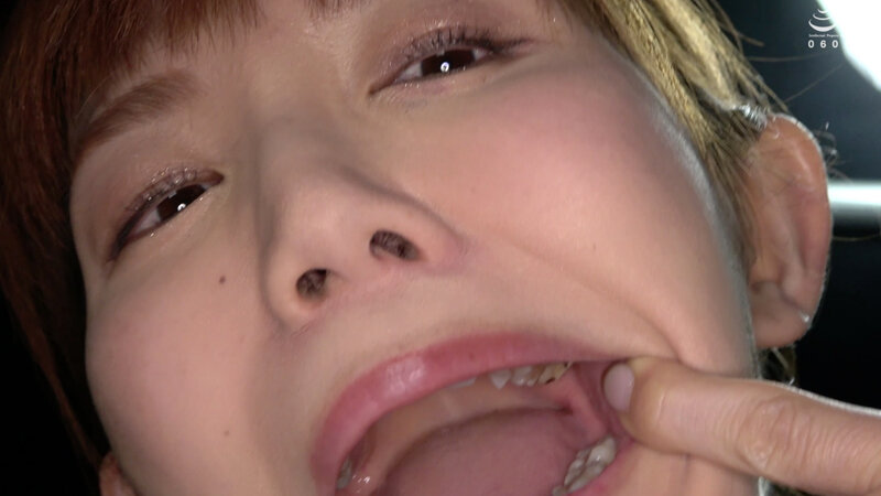 【歯・口内フェチ】綺麗なお姉さんの激レアな治療跡がある歯・口内・のどちんこ観察! 美泉咲