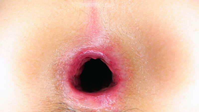 お嬢様は肉便器 生田りん ＃アナル ＃ゲロ ＃開口器 ＃ハードイラマチオ