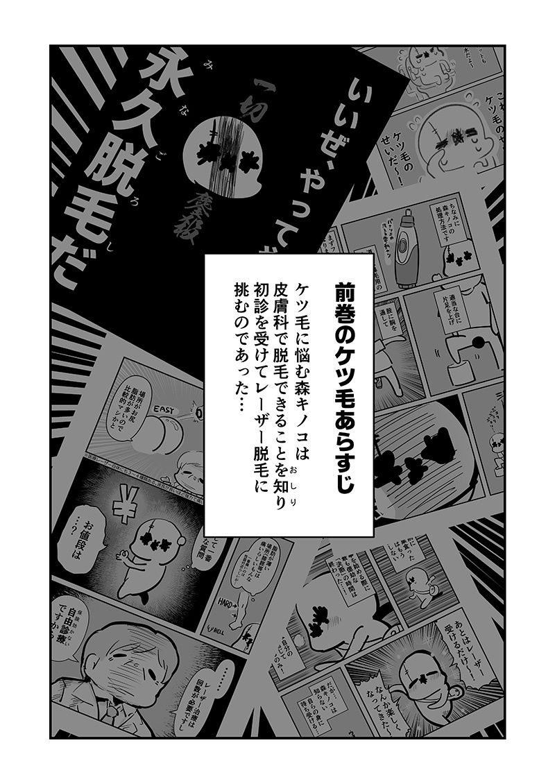 アナルをレーザーで焼いた話 その2