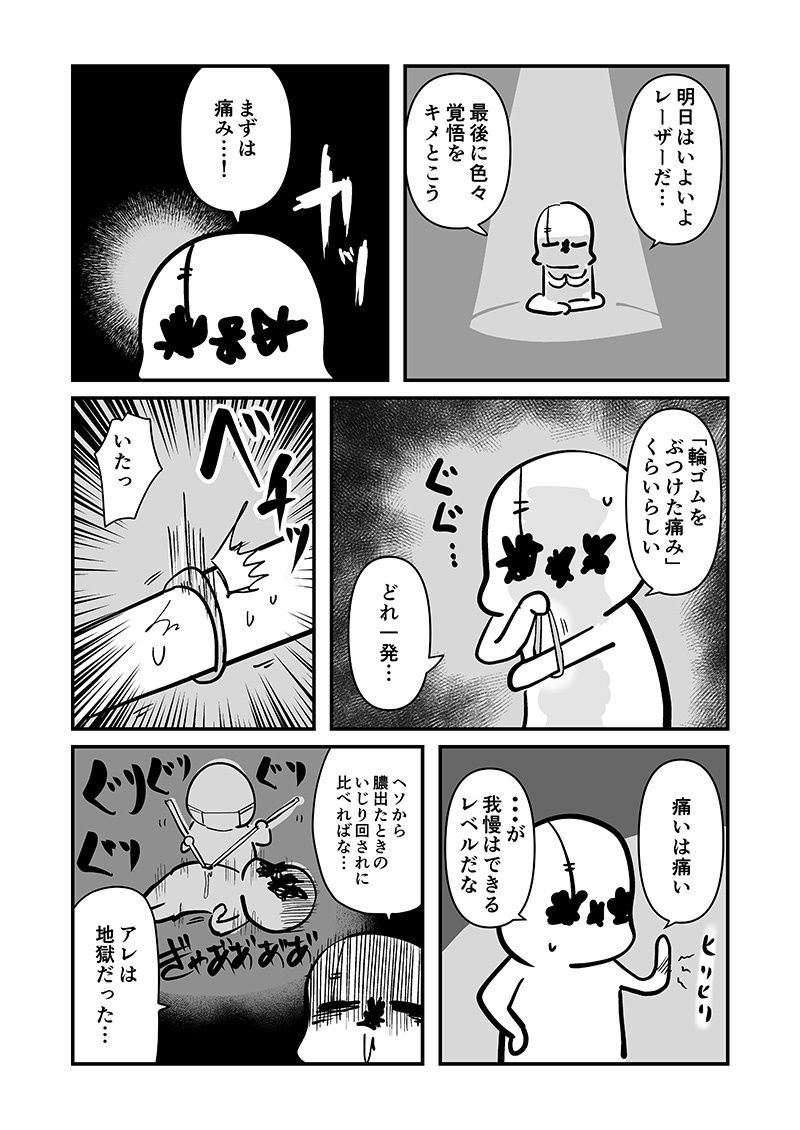 アナルをレーザーで焼いた話 その2