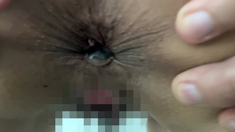 街角で声をかけてアナル観察させてもらう エッチで金欠な女の子 ゆりなちゃん
