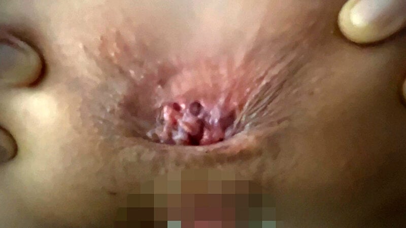 街角で声をかけてアナル観察させてもらう エッチで金欠な女の子 ゆりなちゃん