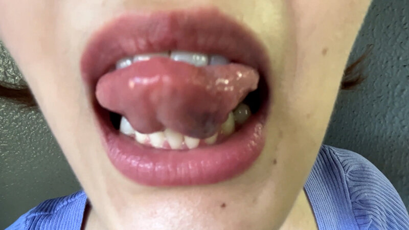 街角で声をかけて口内観察させてもらう アパレル店員 さつきちゃん