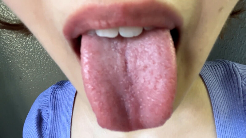 街角で声をかけて口内観察させてもらう アパレル店員 さつきちゃん