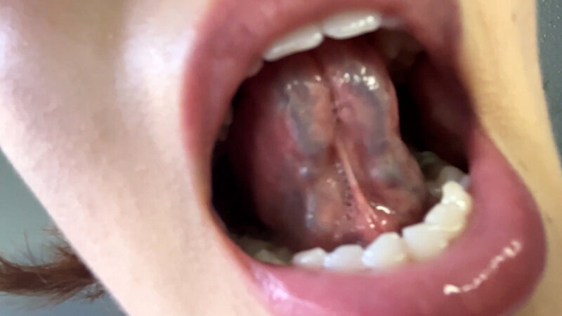 街角で声をかけて口内観察させてもらう アパレル店員 さつきちゃん