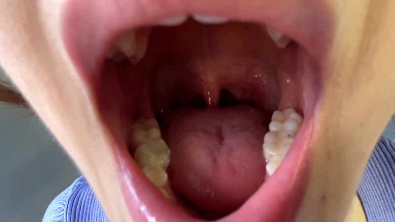 街角で声をかけて口内観察させてもらう アパレル店員 さつきちゃん