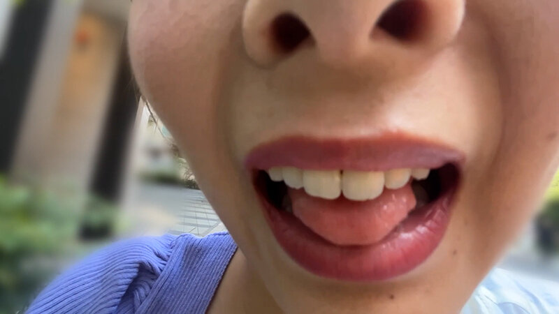 街角で声をかけて口内観察させてもらう アパレル店員 さつきちゃん