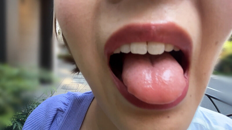 街角で声をかけて口内観察させてもらう アパレル店員 さつきちゃん