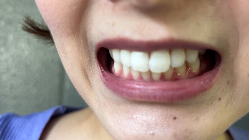 街角で声をかけて口内観察させてもらう アパレル店員 さつきちゃん