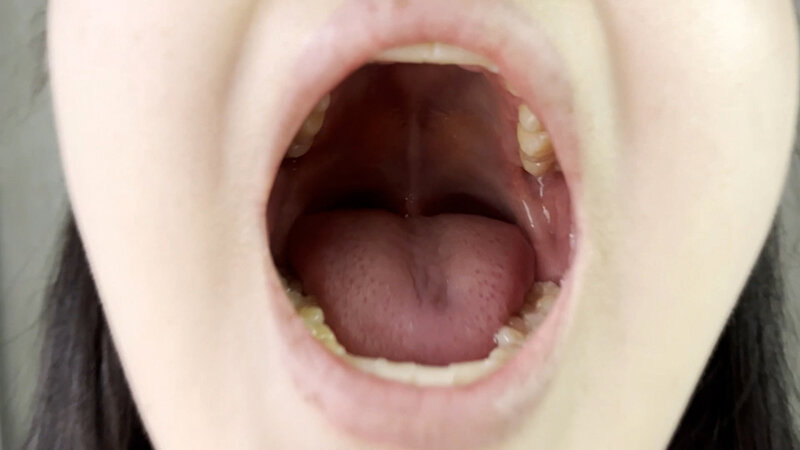 街角で声をかけて口内観察させてもらう 書店員 りかちゃん