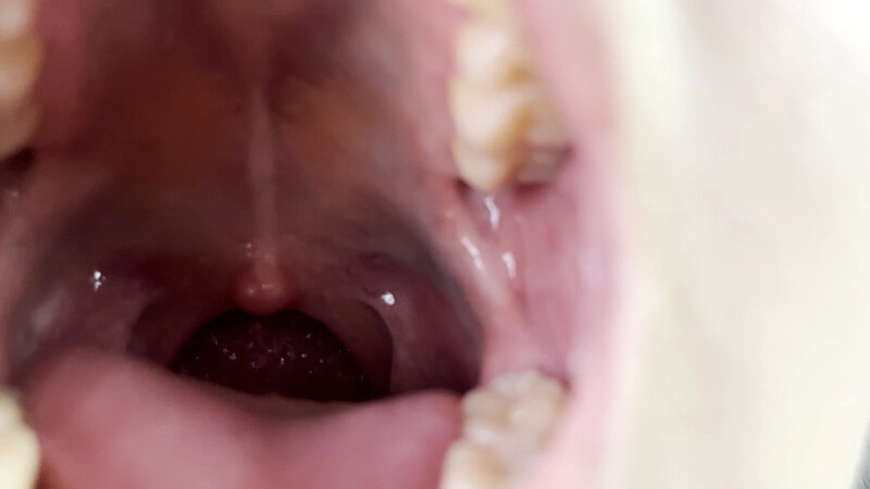 街角で声をかけて口内観察させてもらう 書店員 りかちゃん