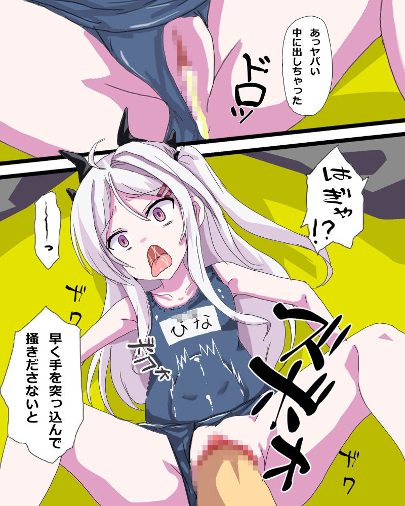 子宮脱アーカイブ