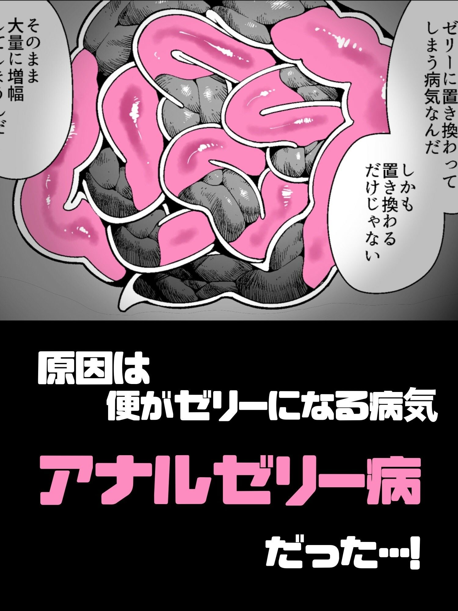 アナルゼリーという病〜人妻OLは我慢も虚しく巨尻からゼリーを吹き出す〜